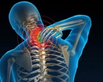 Phục hồi chức năng thoái hóa cột sống cổ 